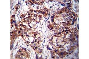 Immunohistochemistry (IHC) image for anti-Discoidin Domain Receptor tyrosine Kinase 1 (DDR1) (AA 299-330) antibody (ABIN3030734)