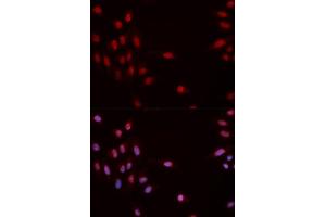 Immunofluorescence analysis of MCF-7 cells using Phospho-CHEK1-S317 antibody (ABIN5969879). (CHEK1 antibody  (pSer317))