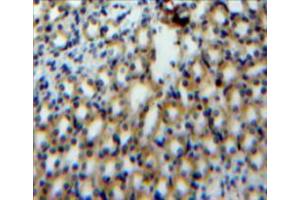 Used in DAB staining on fromalin fixed paraffin-embedded kidney tissue (S100A3 antibody  (AA 1-101))