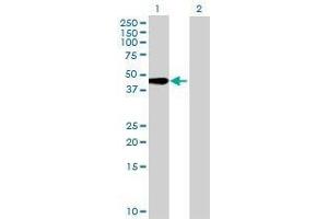 Lane 1: TMEM49 transfected lysate ( 44. (TMEM49 293T Cell Transient Overexpression Lysate(Denatured))