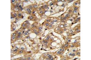 Immunohistochemistry (IHC) image for anti-Interferon, beta 1, Fibroblast (IFNB1) (AA 39-66) antibody (ABIN3028749)