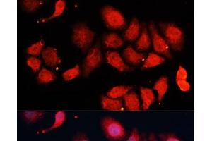 Immunofluorescence analysis of HeLa cells using CDK7 Polyclonal Antibody at dilution of 1:100 (40x lens). (CDK7 antibody)