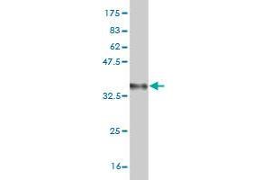 Western Blot detection against Immunogen (36. (OXSR1 antibody  (AA 351-450))