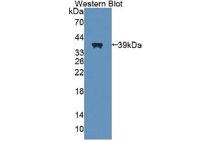 Figure. (ANKRD1 antibody  (AA 6-291))