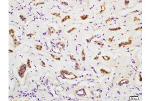Formalin-fixed and paraffin embedded human kidney labeled with Rabbit Anti-PMVK Polyclonal Antibody, Unconjugated  at 1:200 followed by conjugation to the secondary antibody and DAB staining (PMVK antibody  (AA 15-120))