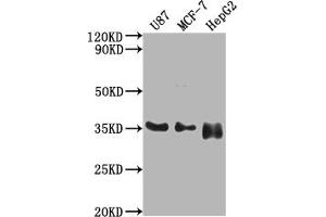 Western Blot Positive WB detected in: U87 whole cell lysate, MCF-7 whole cell lysate, HepG2 whole cell lysate All lanes: HMGCL antibody at 1:2000 Secondary Goat polyclonal to rabbit IgG at 1/50000 dilution Predicted band size: 35, 27, 21 kDa Observed band size: 35 kDa (HMGCL antibody  (AA 28-325))