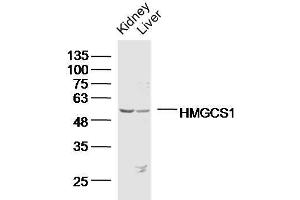 Lane 1: Mouse kidney lysates, Lane 2: Mouse liver lysates probed with HMGCS1 Polyclonal Antibody, Unconjugated  at 1:300 overnight at 4˚C. (HMGCS1 antibody  (AA 41-150))