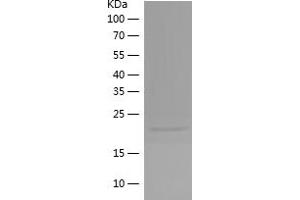 Western Blotting (WB) image for RAC1 (AA 1-192) protein (His tag) (ABIN7124767) (RAC1 Protein (AA 1-192) (His tag))