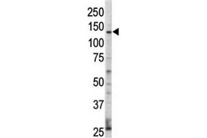 Western blot analysis of ErbB4 / HER4 antibody and HL-60 cell lysate. (ERBB4 antibody  (AA 25-55))