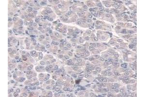 Detection of SULF2 in Mouse Esophagus Tissue using Polyclonal Antibody to Sulfatase 2 (SULF2)