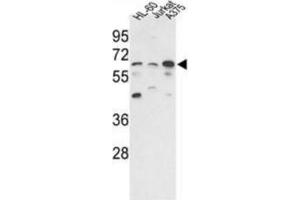 Western blot of hPPP3CC-E33 AP31353PU-N in HL-60, Jurkat, A375 cell line lysates (35 ug/lane). (PPP3CC antibody  (N-Term))