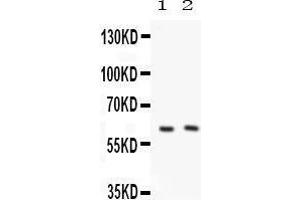 Anti-PKLR Picoband antibody, Western blotting All lanes: Anti PKLR  at 0. (PKLR antibody  (C-Term))