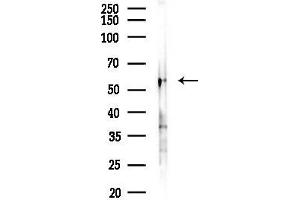 Western blot analysis of lysates from F10-LUC cells(uv30 min treatment), using FOXC1/2 Antibody at 1/1000 dilution.