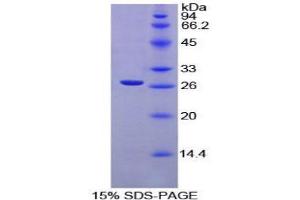 SDS-PAGE (SDS) image for X-Ray Repair Complementing Defective Repair in Chinese Hamster Cells 6 (XRCC6) (AA 397-603) protein (His tag) (ABIN1879004)