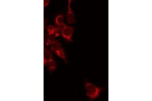 ABIN6277181 staining Hela by IF/ICC. (RAPGEF3 antibody  (C-Term))