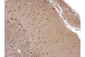 IHC-P Image O-GlcNAc transferase antibody detects O-GlcNAc transferase protein at cytoplasm and nucleus on rat hind brain by immunohistochemical analysis. (OGT antibody)