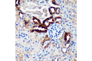 Immunohistochemistry of paraffin-embedded Mouse kidney using EML4 Rabbit pAb (ABIN7266891) at dilution of 1:100 (40x lens).