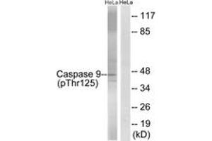 Western blot analysis of extracts from HeLa cells treated with TNF 20ng/ml 5'+calyculinA 50ng/ml 5', using Caspase 9 (Phospho-Thr125) Antibody. (Caspase 9 antibody  (pThr125))