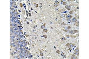 Immunohistochemistry of paraffin-embedded Rat brain using EIF3C Polyclonal Antibody at dilution of 1:100 (40x lens).