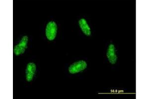 Image no. 2 for anti-Sin3A-Associated Protein, 30kDa (SAP30) (AA 131-220) antibody (ABIN599070) (SAP30 antibody  (AA 131-220))