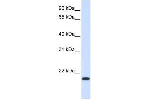 NKAIN1 antibody used at 1 ug/ml to detect target protein. (NKAIN1 antibody  (Middle Region))