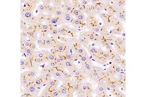 Immunohistochemistry of paraffin embedded human liver using Kiaa1324 (ABIN7073822) at dilution of 1:2500 (400x lens) (ELAPOR1 antibody)
