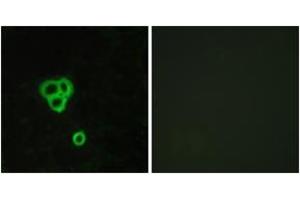 Immunofluorescence analysis of MCF7 cells, using GPR119 Antibody.
