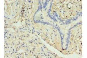 Immunohistochemistry (IHC) image for anti-Dopamine Receptor D5 (DRD5) (AA 361-477) antibody (ABIN7149470)