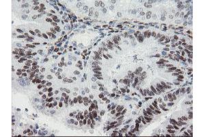 Image no. 2 for anti-Transducin-Like Enhancer of Split 1 (E(sp1) Homolog, Drosophila) (TLE1) (AA 180-460) antibody (ABIN1491047) (TLE1 antibody  (AA 180-460))