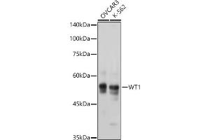 Western blot analysis of extracts of various cell lines, using WT1 antibody  at 1:1000 dilution. (WT1 antibody)