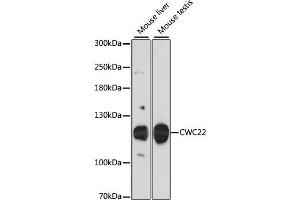 Western blot analysis of extracts of various cell lines, using CWC22 antibody. (CWC22 antibody)
