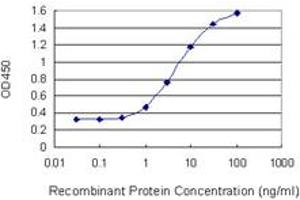 Detection limit for recombinant GST tagged GALK1 is 0. (GALK1 antibody  (AA 181-279))