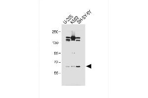 All lanes : Anti-LM3 Antibody (C-term) at 1:1000 dilution Lane 1: U-20S whole cell lysate Lane 2: K562 whole cell lysate Lane 3: SH-SY-5Y whole cell lysate Lysates/proteins at 20 μg per lane.