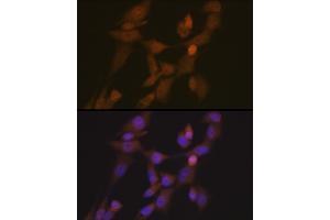 Immunofluorescence analysis of NIH-3T3 cells using STK33 Rabbit mAb (ABIN7270224) at dilution of 1:100 (40x lens). (STK33 antibody)