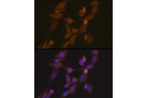 Immunofluorescence analysis of NIH-3T3 cells using STK33 Rabbit mAb (ABIN7270224) at dilution of 1:100 (40x lens).