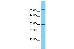 Western Blotting (WB) image for anti-Storkhead Box 2 (STOX2) (C-Term) antibody (ABIN2791141) (STOX2 antibody  (C-Term))