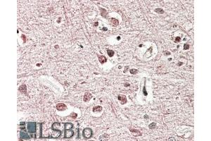 ABIN571205 (3. (GRM2 antibody  (Internal Region))