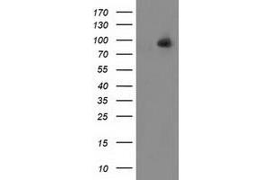 HEK293T cells were transfected with the pCMV6-ENTRY control (Left lane) or pCMV6-ENTRY ALDH1L1 (Right lane) cDNA for 48 hrs and lysed. (ALDH1L1 antibody)