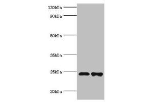 Western blot All lanes: Toll/interleukin-1 receptor domain-containing adapter protein antibody at 2 μg/mL Lane 1: K562 whole cell lysate Lane 2: Mouse kidney tissue Secondary Goat polyclonal to rabbit IgG at 1/10000 dilution Predicted band size: 24, 26, 28 kDa Observed band size: 24 kDa (TIRAP antibody  (AA 1-221))