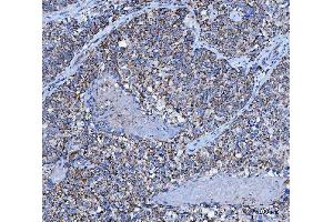 IHC analysis of TRK fused gene/TFG using anti-TRK fused gene/TFG antibody (ABIN7599839). (TFG antibody  (AA 121-400))