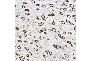 Immunohistochemistry of paraffin-embedded rat brain using RPL17 Rabbit pAb (ABIN6128342, ABIN6147115, ABIN6147116 and ABIN6221632) at dilution of 1:100 (40x lens). (RPL17 antibody  (AA 1-184))