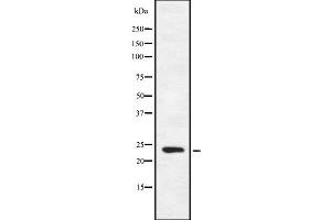 Western blot analysis FGF16 using HeLa whole cell lysates (FGF16 antibody  (Internal Region))