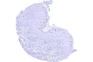 anti-Cyclin E1 (CCNE1) antibody