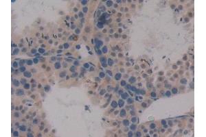 Detection of CXCL16 in Mouse Testis Tissue using Polyclonal Antibody to Chemokine C-X-C-Motif Ligand 16 (CXCL16) (CXCL16 antibody  (AA 31-241))