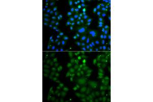 Immunofluorescence analysis of A549 cell using RNF125 antibody. (RNF125 antibody)