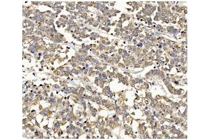 IHC analysis of PI3K-gamma/PIK3CG using anti PI3K-gamma/PIK3CG antibody (ABIN7601952).