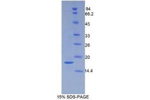 SDS-PAGE (SDS) image for Periostin (POSTN) (AA 500-630) protein (His tag) (ABIN1080495) (Periostin Protein (POSTN) (AA 500-630) (His tag))