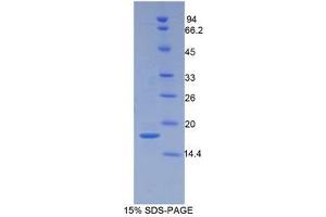 SDS-PAGE (SDS) image for Periostin (POSTN) (AA 500-630) protein (His tag) (ABIN1080491)
