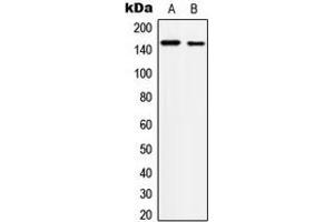 Western blot analysis of c-Met (pY1234) expression in A431 (A), HepG2 (B) whole cell lysates. (c-MET antibody  (C-Term, pTyr1234))