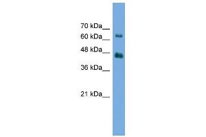 WB Suggested Anti-AGK Antibody Titration: 0. (Acylglycerol Kinase antibody  (N-Term))